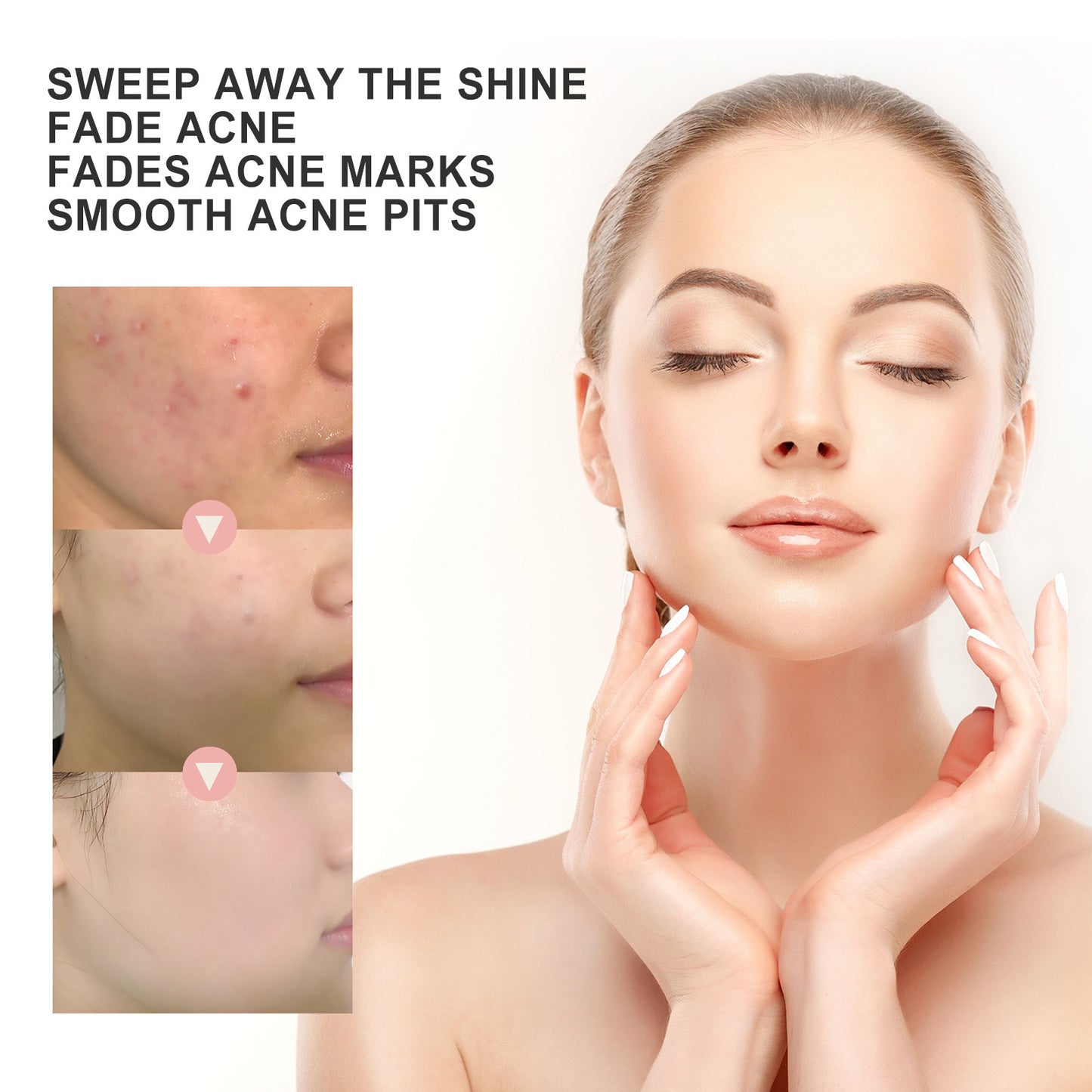 Acne Patch Repair Acne Redness Pore Cleansing & Moisturizing Patch